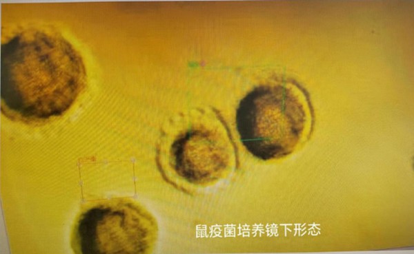 鼠疫3.png